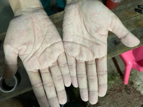 衣服干了又濕，濕了又干——千名馳援吳川核酸采檢人員群像